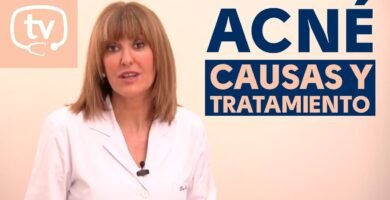 Biomagnetismo en el Tratamiento del Acné