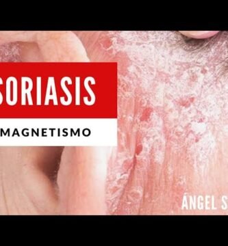 Biomagnetismo para el Tratamiento de Enfermedades de la Piel