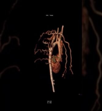 Expertos Opinan: Biomagnetismo y Salud Cardiovascular